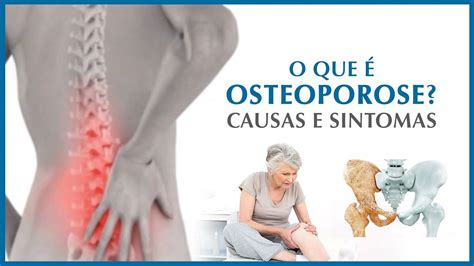sintomas de osteoporose - signo de aries